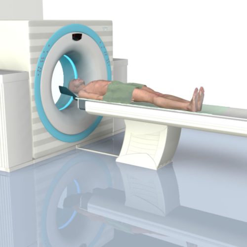 Techniche 3D Visualisierung: PET / SPECT. Mann liegt auf Liege und wird gescannt.